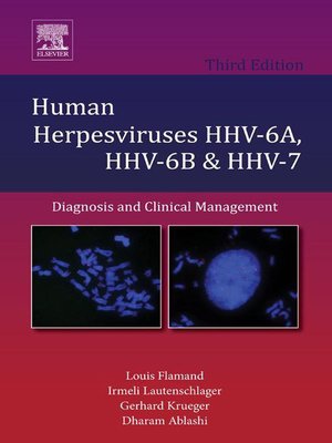 cover image of Human Herpesviruses HHV-6A, HHV-6B and HHV-7